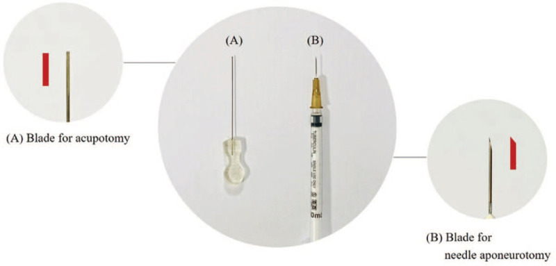 Acupotomy 1