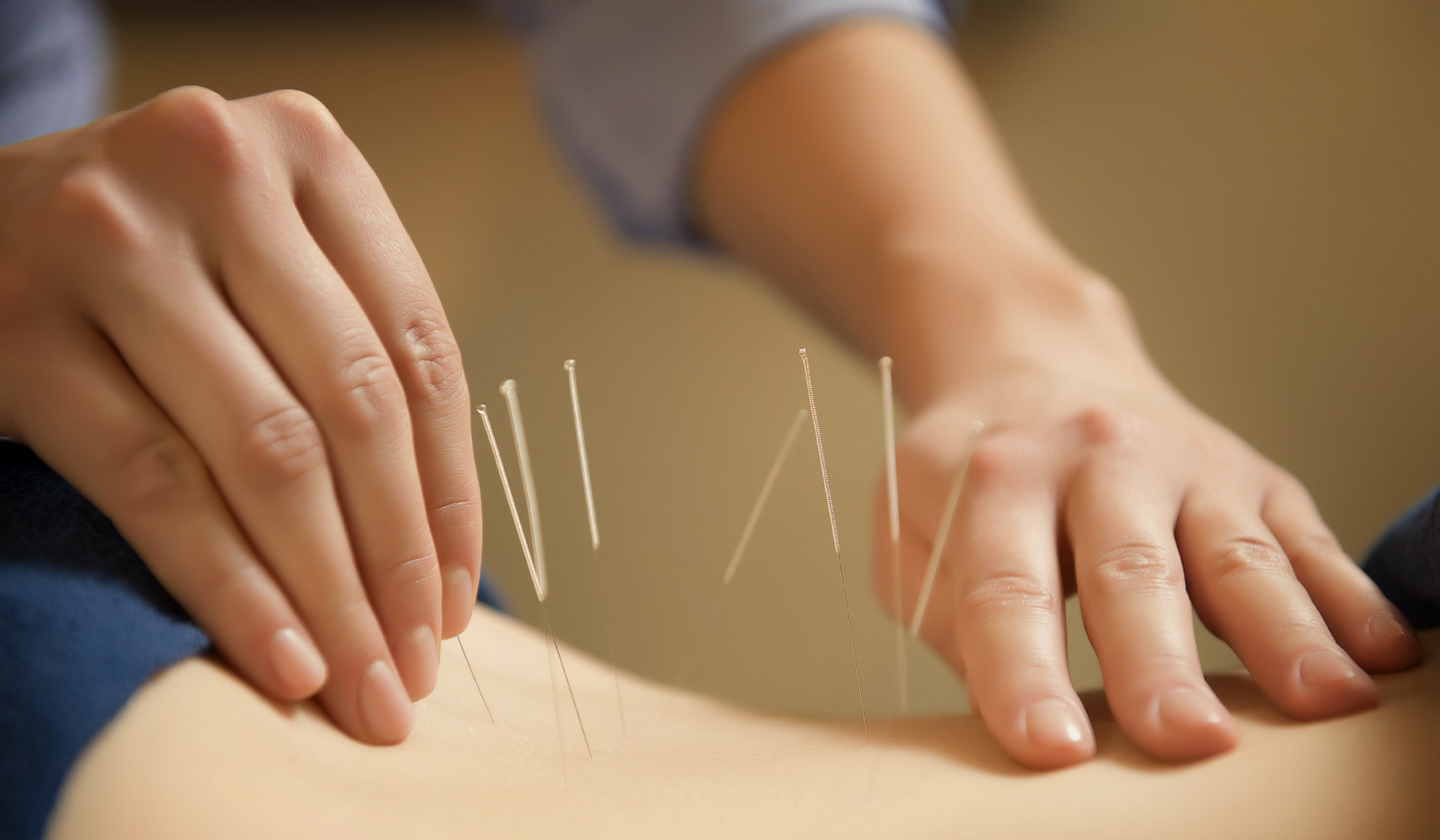 Acupuncture & ACC Appointments 1