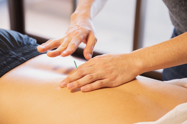 Acupuncture & ACC Appointments 2