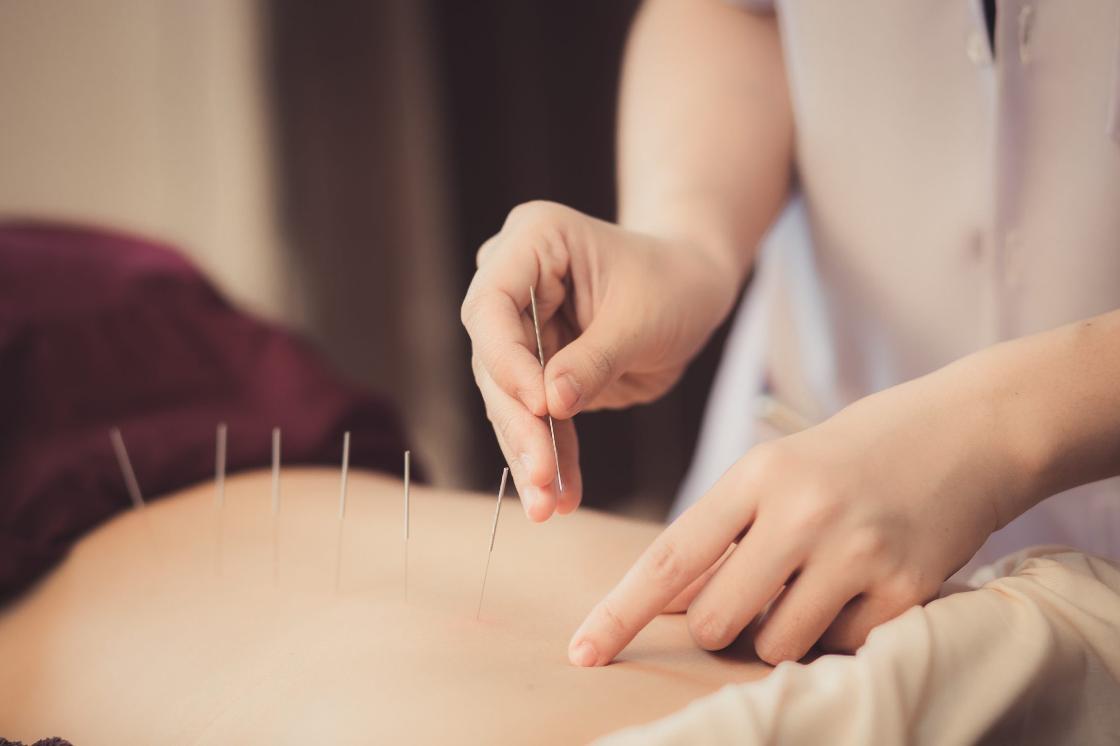 Acupuncture & ACC Appointments 3