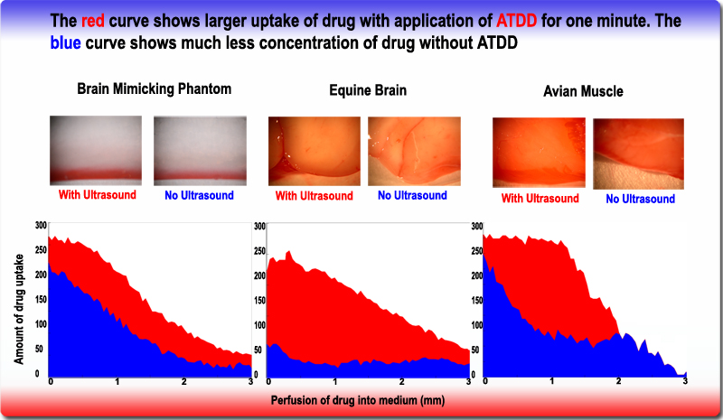 Cryotherapy & Ultrasound 1