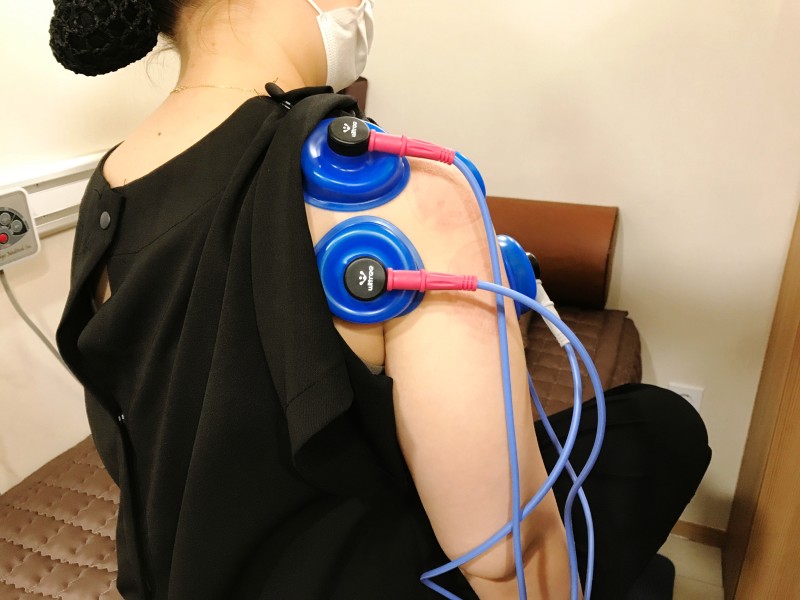 Interferential Current Therapy 3