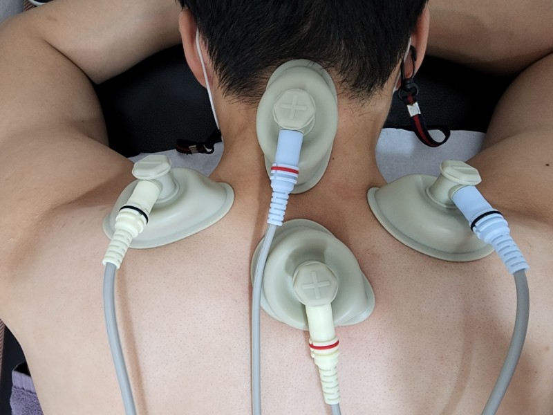 Cryotherapy & Ultrasound 2