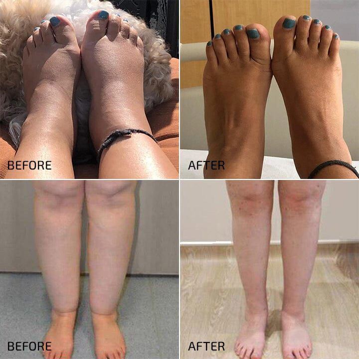 Manual Lymphatic Drainage 3