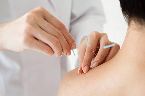 Motion Acupuncture 1