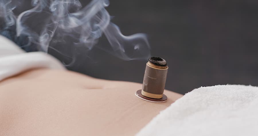 Moxibustion 3